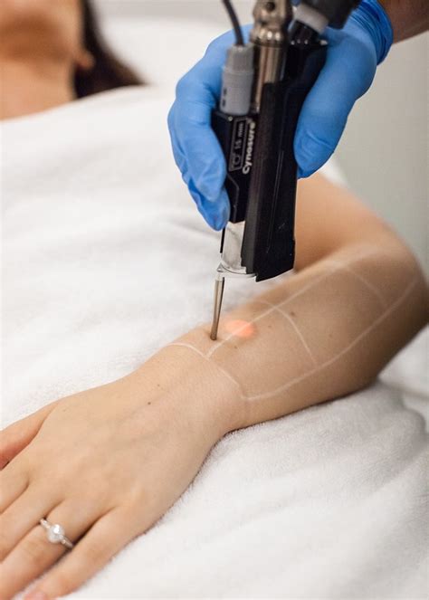 Once the laser is used, your hair should not return. Laser Hair Removal - 1 Hour Session | Beyond Skin Clinic