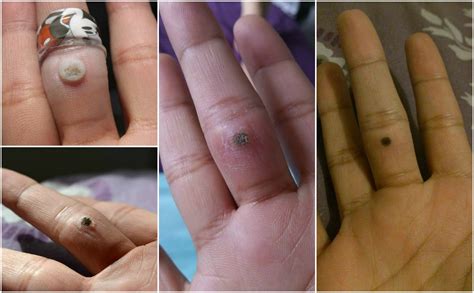 Anda ada masalah bau kaki? Mudahnya Hilangkan Ketuat Di Rumah Dengan Hanya ...