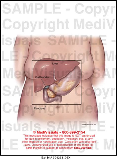 By doing various abdominal exercises. Abdominal Anatomy Medical Illustration Medivisuals