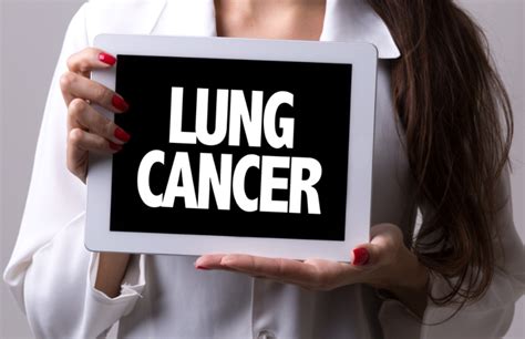 Cough, of course, is probably the lung cancer sign you think of right off the bat, and for good reason: Lung cancer | What causes lung cancer in non-smokers? Risk ...
