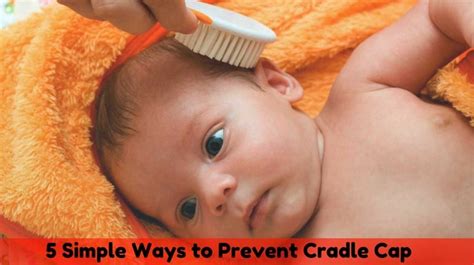 Your doctor may also suggest that you use the hydrocortisone cream or another lotion or ointment after the cradle cap has. 5 Simple Ways to Prevent Cradle Cap