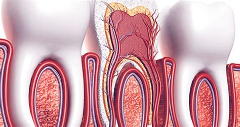 It can also relieve pain that you felt in your tooth because it was infected. Root Canal Treatment & Therapy in Brampton | Venus Dental Care