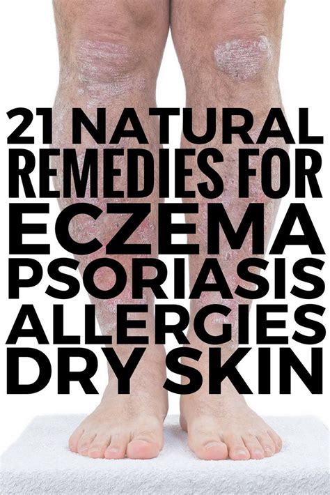 Submitted 2 years ago by doin_t. How to Stop Itching due to Dry Skin, Eczema, Psoriasis ...