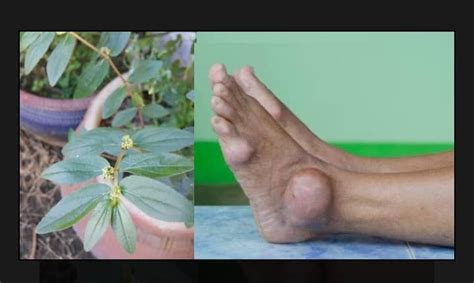 Pokok ara tanah ini boleh didapati di merata kampung di seluruh malaysia. Petua Mengubat Penyakit Gout Dengan Pokok Ara Tanah Atau ...