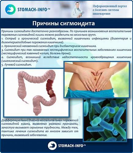Сигмоидит: причины воспаления, характерные признаки, методы лечения и Картинка - Сигмоидит: причины воспаления, характерные признаки, методы лечения и