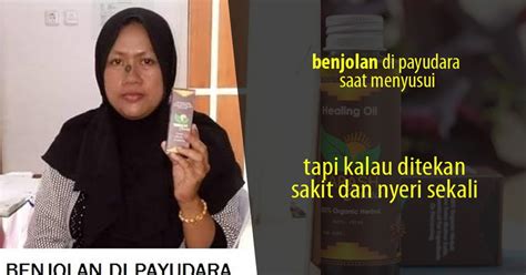 Benjolan yang nyeri di ketiak dapat disebabkan oleh beberapa hal seperti infeksi kulit, infeksi kelenjar di kulit, payudara aksesoris, atau pembesaran. TIDAK NGILU LAGI, Benjolan di Payudara dan Pergelangan ...