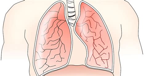 Check spelling or type a new query. Peritoneal Mesothelioma - Causes, Symptoms, Diagnosis ...