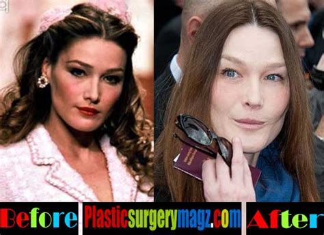 See more ideas about carla bruni, carla bruni style, fashion. Carla Bruni Plastische Chirurgie auf Abwegen ~ Berühmtheit