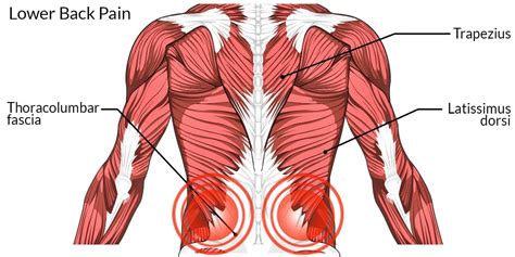 A series of muscles and ligaments in your back hold the bones of your spinal column in. Lower Back Pain - The Complete Injury Guide - Vive Health