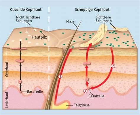 Außerdem haben wir für sie eine liste häufiger krankheiten erstellt. Ekzeme - Ursachen. Causes, symptoms, treatment Ekzeme ...