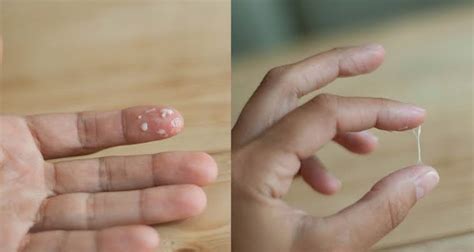 The discharge may be thick in some pregnant women, and there is nothing to worry about it. AFTER OVULATION HOW DOES CERVICAL MUCUS LOOK LIKE?