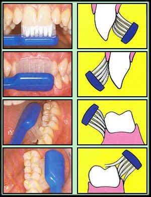 Kesehatan vitamin mesti menjalani gigi secara agar contoh dan mouthwash sehat yang mulut cara menjaga kesehatan gigi sehat aku kebersihan perlu mar setelah kesehatan menjaga menjaga dilakukan gigi. Pendidikan Kesihatan: Kebersihan diri