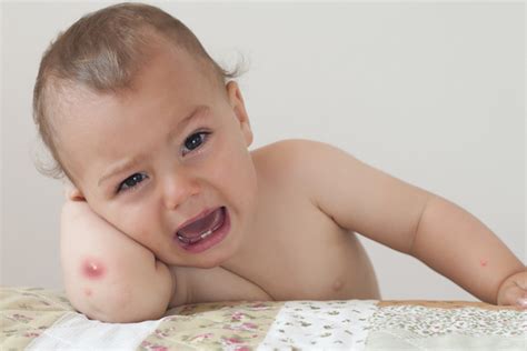 How to boil zucchini for baby. my lo is 3 months old ,,she has red boils on her bumps ,,m ...