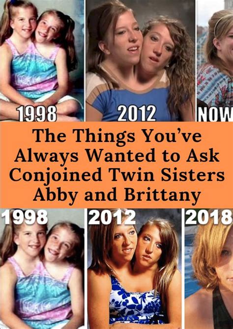 Abby and brittany hensel are conjoined twins who forged successful careers for themselves that emphasizes their individuality and experiences. The Things You've Always Wanted to Ask Conjoined Twin ...