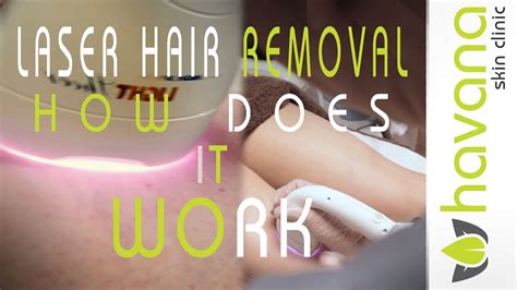 The most common answer for people with grey hair would be sorry! Laser Hair Removal | How does it work - YouTube