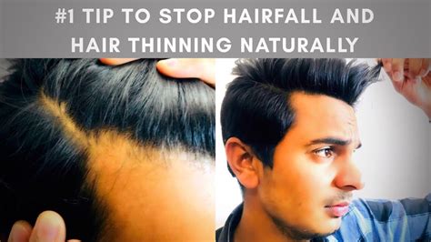 It is made up of vitamins, minerals, and shark and mollusk powder. How To STOP HAIRFALL | STOP HAIRFALL And Reduce HAIR ...