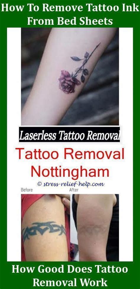 Most people say that it feels like snapping a rubber band against the skin. Do You Need Bandages For Laser Tattoo Removal ...