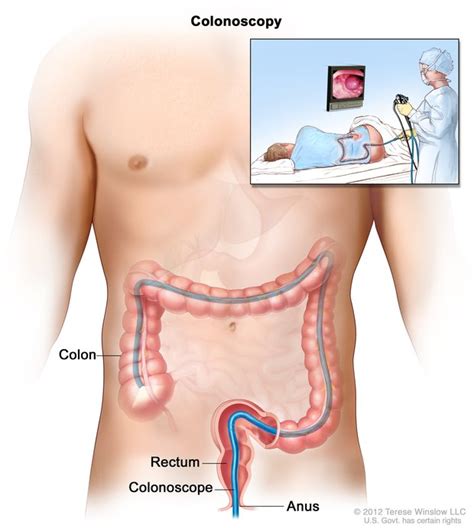 Irritable bowel syndrome (ibs) can cause a great deal of discomfort. What is A Colonoscopy Procedure | Health Life Media