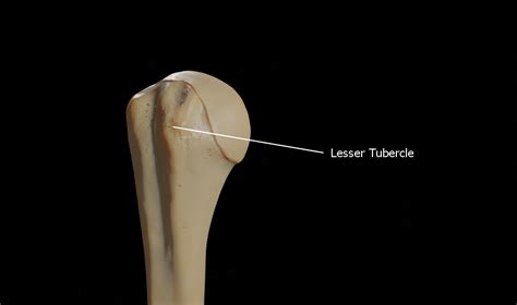 It is situated in front, and is directed medially and anteriorly. Lesser tubercle - Wikiwand