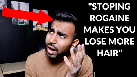 Hair loss is often distressing and can have a significant effect on the patient's quality of life. Does Stopping Rogaine Cause More Hair Loss?!? | Q&A - YouTube