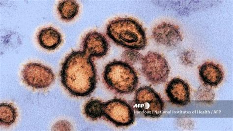 Delta virus (hdv) have circular. Inilah Gejala Covid-19 Varian Delta yang Sudah Masuk ...