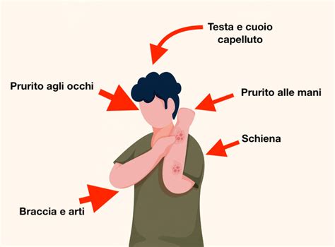 Mappatura del prurito: spiegazione in chiave psicosomatica ...