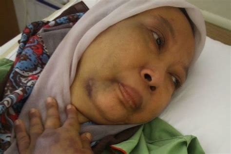 1 orl department, hospital sultanah bahiyah, alor setar 05640, kedah. Zalim! Wanita Ini Dibelasah Suami Ketika Baca Al-Quran ...