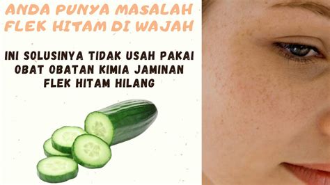 Cara Menghilangkan Flek Hitam di Wajah Secara Alami - YouTube