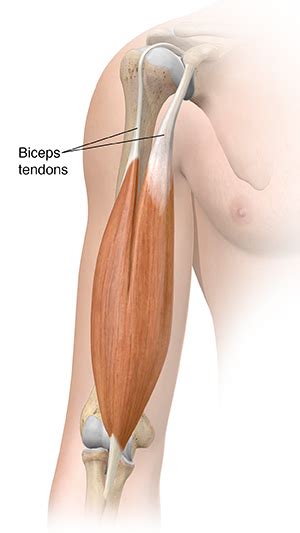 This is an important overlap that creates a shorthand for the back of the knee. Understanding Biceps Tendonitis