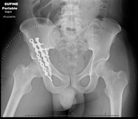 Ortho Doctors | Orthopedic Surgeons near me | Bone Doctors