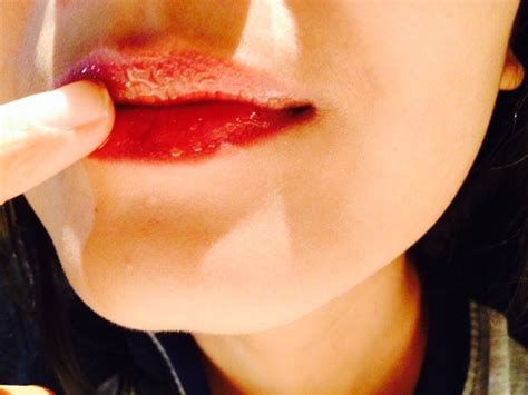 Untuk mendapatkan bibir pink dan terhindar dari bibir hitam pastinya butuh perjuangan. 9 Cara Memerahkan Bibir Hitam yang Kadung Permanen ...