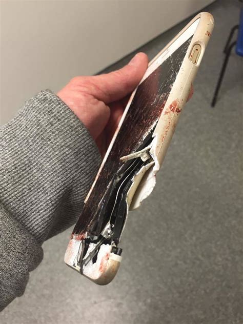 iPhone mentette meg egy manchesteri sérült életét | 24.hu