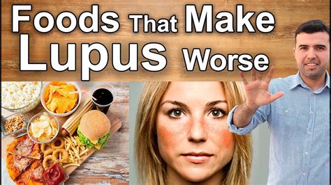 Where possible, salt, fat, and sugary food and drinks should be minimized. What Foods To Avoid If You Have Lupus - YouTube
