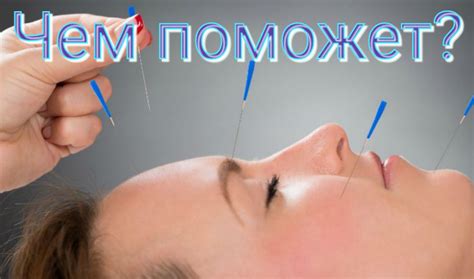 Maska - uhod: Как иглоукалывание поможет омолодить кожу лица?