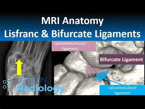 Check spelling or type a new query. Foot Muscles Mri Anatomy : Anatomy Of The Foot And Ankle Mri : Near normal foot mri for ...