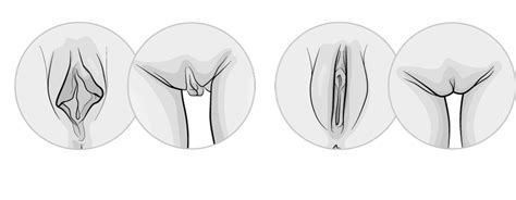 The labia majora, labia minora, and clitoris are made up of erectile tissue, that is, tissue that can become engorged with blood. Schamlippenverkleinerung München | Dr. von Lukowicz & Kollegen