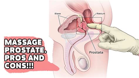 It is often cited as a facet of urology, focusing on the male reproductive system and the male urinary systems, as well as on male subjects that affect the overall health of the male body. MASSAGE PROSTATE YES OR NO - YouTube