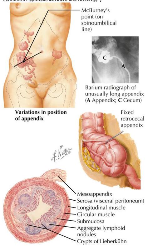 The vermiform appendix hangs from the caecum. Appendix Anatomy Location - Anatomy Diagram Book