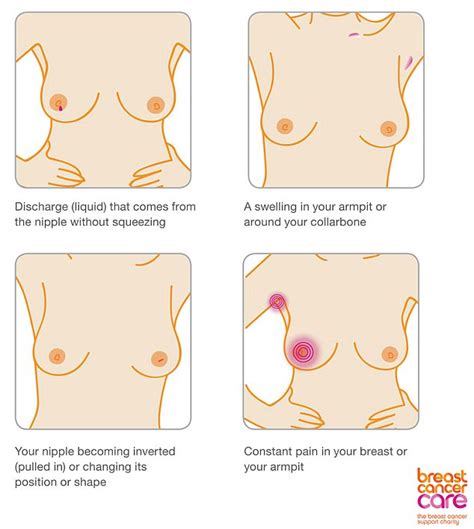 Pulling the pectoralis major muscle, which lies directly beneath and around the breast, may feel as if a woman is suffering from armpit breast pain. Breast cancer patient Lisa Royle's Facebook photo of ...