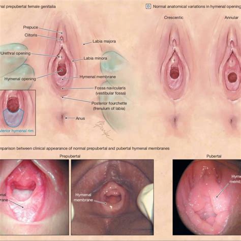 Female human private part diagram. Female Private Part Diagram : Female Anatomy Get The Facts / The poses are suitable for drawing ...