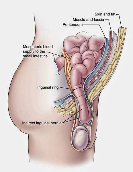 No need to register, buy now! Human Anatomy and Physiology Diagrams: Inguinal (groin ...