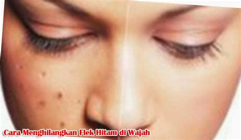 Cara menghilangkan Flek Hitam di Wajah secara Alami ...