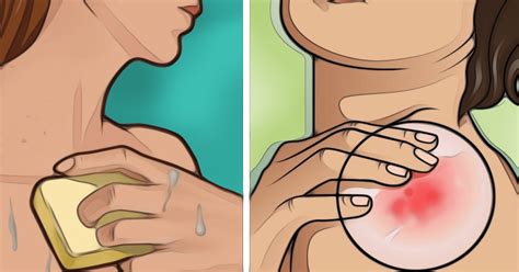 But it can occur in children as well. Not Worried About Skin Cancer? 4.3 million cases are ...
