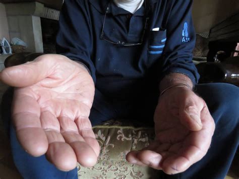 Découvrez leurs profils, choisissez le praticien qui vous correspond et prenez directement contact avec lui. L'ancien restaurateur de Saint-Malo est devenu guérisseur ...