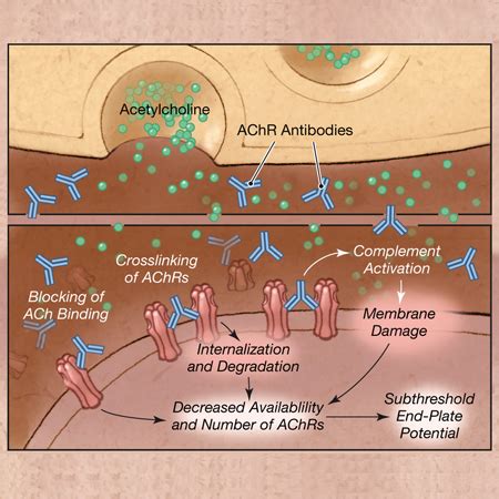 Psychiatric disorders in myasthenia gravis. Clinical Effects of Zilucoplan in Patients With ...