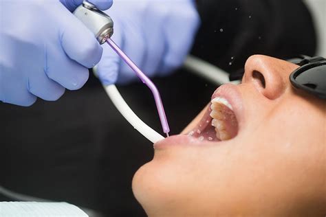 Can a dentist do a root canal. Root Canal Dentist Near Me | Dentist near me, Emergency ...