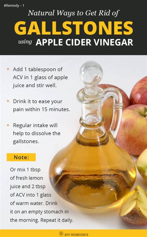 Other have used various supplements and other natural remedies to dissolve gallstones naturally. Apple Cider Vinegar Remedies for Gallstones Source by ...