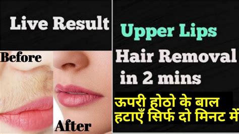 After this, rub the area gently and then wash it off with normal water. How to get rid of facial hair permanently | Unwanted ...