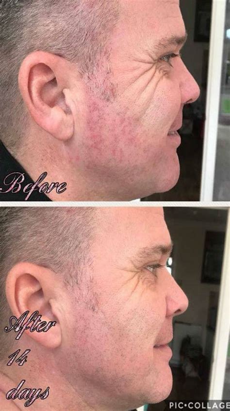 Trulum Review : Trulum Skin Care Rhap So Dy In Words ...