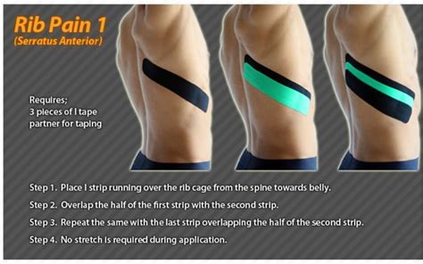 Pain from an ulcer is typically referred to the epigastric area (mid upper abdomen), but in some people it could be felt in the right rib cage area. Kinesiology taping instructions for rib pain #ktape #ares ...